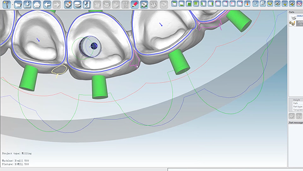 hyper dent.png hyper dent.png